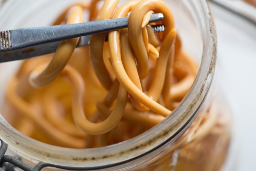 20 Of The Deadliest Animals in the World (Incl. Surprises) 20 Ascaris Roundworms e1656975968980